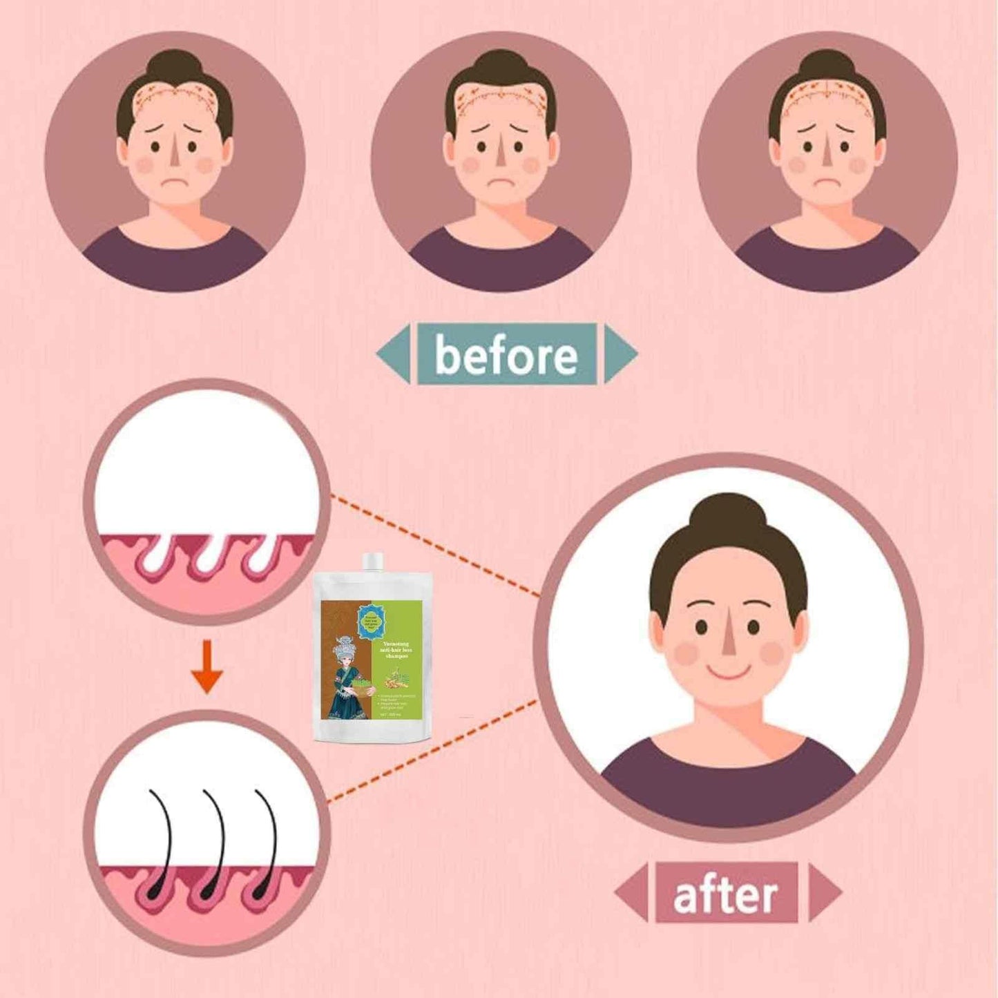 Anti-Hair Loss Strengthening Shampoo 120ML – Nourishing Scalp Care