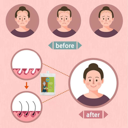 Anti-Hair Loss Strengthening Shampoo 120ML – Nourishing Scalp Care